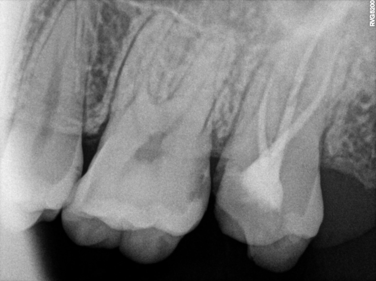 Dental X-ray